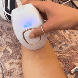 Dispositivo de depilación láser IPL